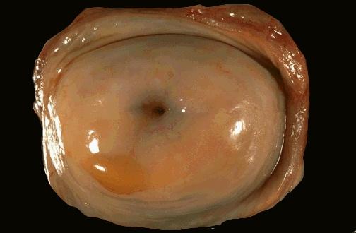 完好的子宫颈图片