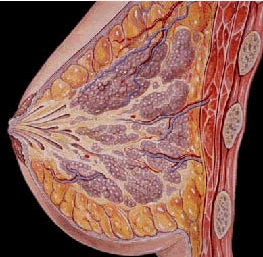 乳腺增生实物图片