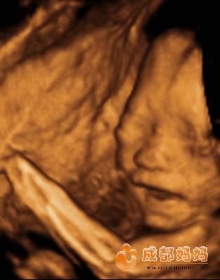 怀孕一个月胎儿图片