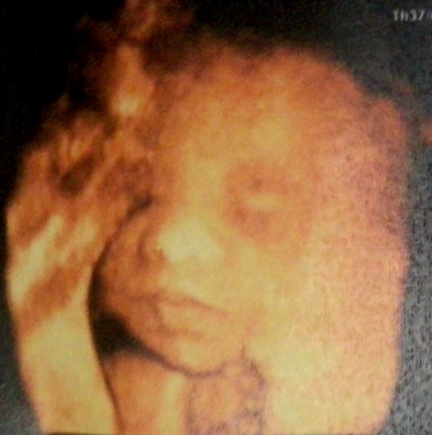 怀孕6个月胎儿图