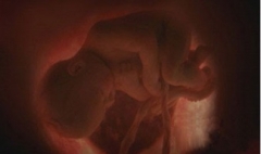 怀孕八个月男胎儿B超图