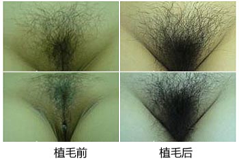 阴毛整理行形状图