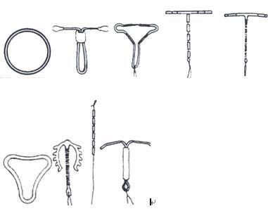 节育环的种类图片