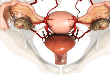 输卵管做造影多少钱
,输卵管堵塞造影图