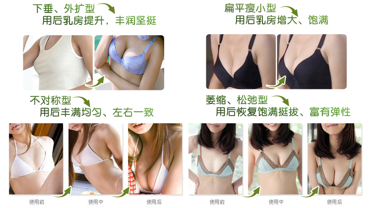 乳腺小叶增生按摩图片