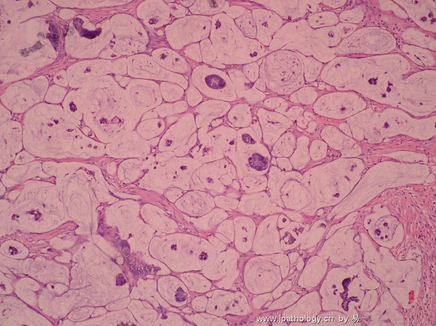 女性盆腔炎的症状图片 女性盆腔炎的症状图片