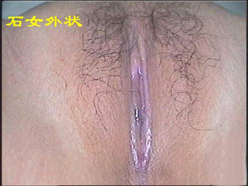 石女是什么样子图片