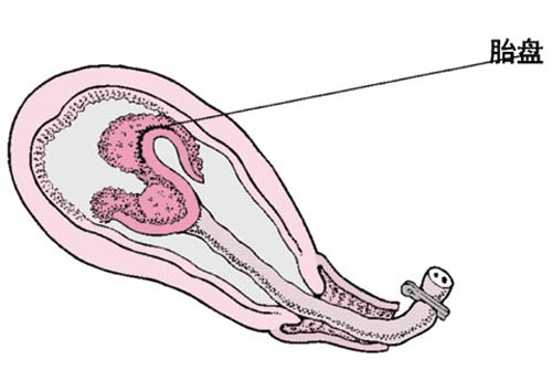 孕妇生娃儿的图片