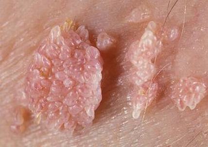 点击查看源网页