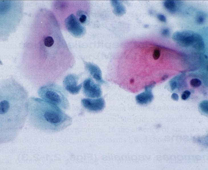 白带发绿是怎么回事